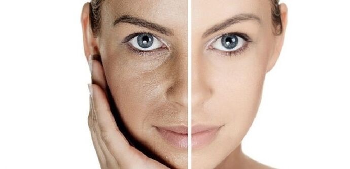 πριν και μετά την αναζωογόνηση του δέρματος του προσώπου